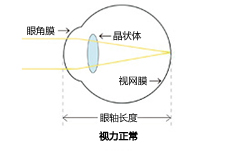 Vol.6 近视・远视・散光・老花