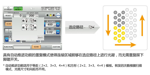 自动推进功能